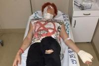 U-KISS Kiseop Menderita Luka Bakar Akibat Ledakan