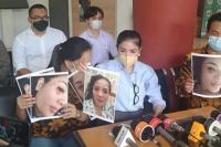 Nindy Ayunda Tunjukkan Bukti Wajah Lebam di KDRT Suami