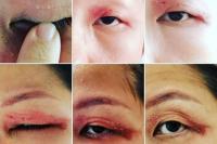 Wanita Ini Beri Peringatan Soal Semut yang Berbahaya dan Berefek Mengerikan