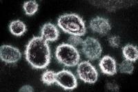 Bukan Mitos, Ini 7 Alergi Paling Tak Masuk Akal di Dunia