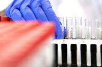 Ilmuwan China Bikin Alat Tes COVID-19 dengan Hasil Cepat