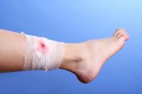 Rintihan Penderita Hemofilia, Impikan Obat Gratis Dari Negara