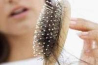 Minuman Manis dan Alkohol Bisa Tingkatkan Risiko Rambut Rontok