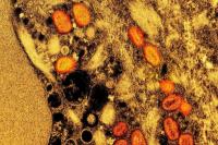 Alergi Paling Aneh di Dunia, Apa Saja?