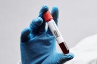 Apa Itu Golongan Darah Golden Blood? 