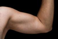 Normalkah Kulit Ketiak Lebih Gelap? Ini Penjelasan Medisnya