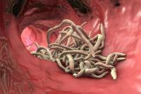 Kenali Gejala Ascariasis pada Balita Sebelum Terlambat