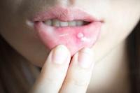 Tanda-Tanda Kekurangan Vitamin C dan Dampak Negatifnya ke Tubuh