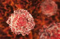 Leukimia Sulit Disembuhkan, Ilmuwan Hadirkan Modifikasi Gen