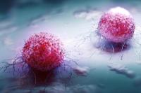 Ilmuwan Berhasil Sulap Sel Imun Tumor Jadi Pembunuh Kanker